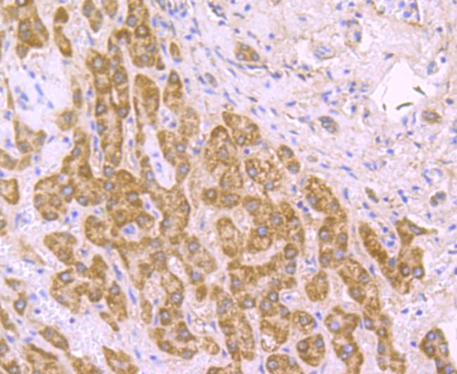 SDHB Antibody in Immunohistochemistry (Paraffin) (IHC (P))