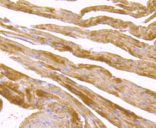 SDHB Antibody in Immunohistochemistry (Paraffin) (IHC (P))