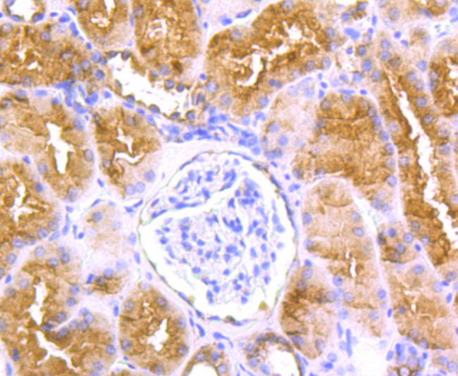 LOX Antibody in Immunohistochemistry (Paraffin) (IHC (P))