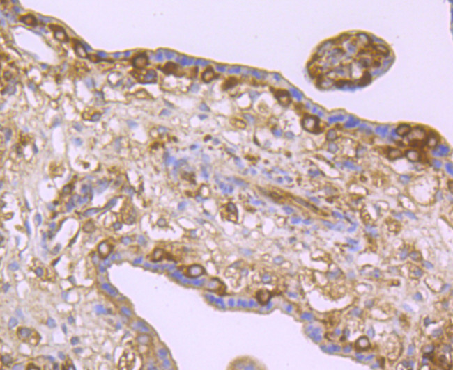 LOX Antibody in Immunohistochemistry (Paraffin) (IHC (P))