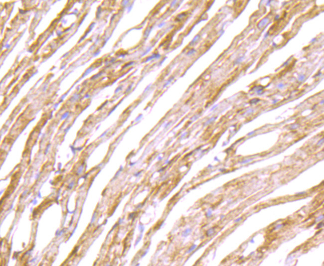 LOX Antibody in Immunohistochemistry (Paraffin) (IHC (P))