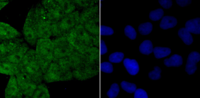 Drosha Antibody in Immunocytochemistry (ICC/IF)