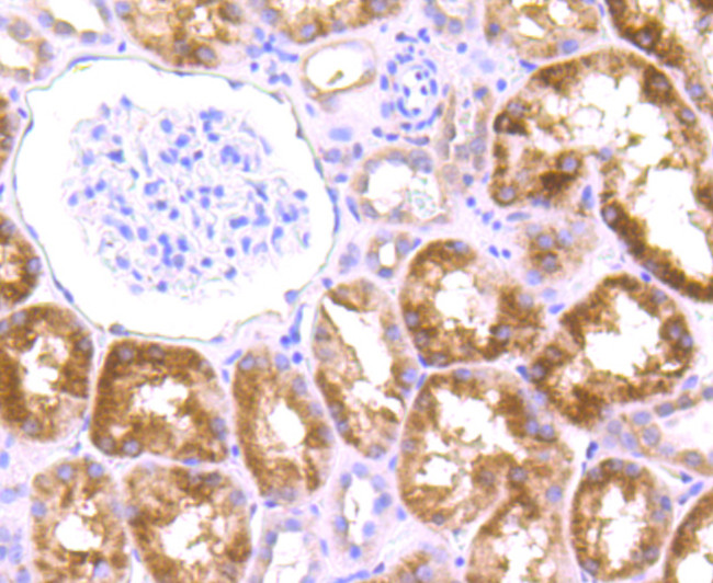 Drosha Antibody in Immunohistochemistry (Paraffin) (IHC (P))