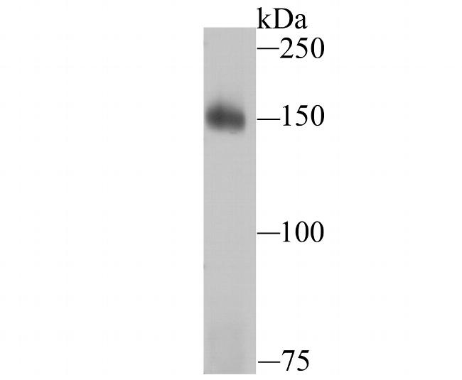 Drosha Antibody in Western Blot (WB)