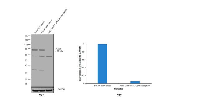 TGM2 Antibody in Western Blot (WB)