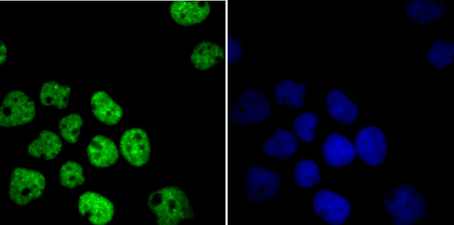 HDAC9 Antibody in Immunocytochemistry (ICC/IF)