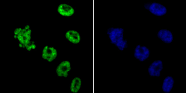 HDAC9 Antibody in Immunocytochemistry (ICC/IF)