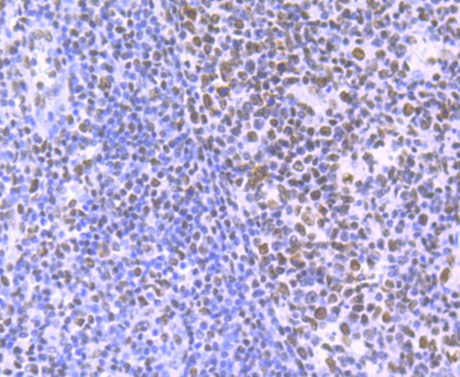 HDAC9 Antibody in Immunohistochemistry (Paraffin) (IHC (P))