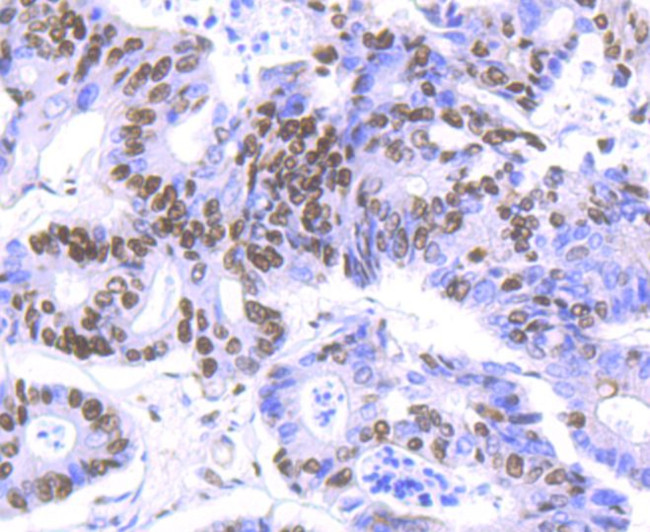 HDAC9 Antibody in Immunohistochemistry (Paraffin) (IHC (P))