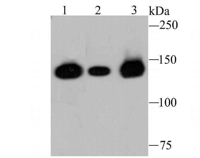 HDAC9 Antibody in Western Blot (WB)