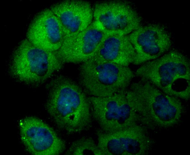 USP14 Antibody in Immunocytochemistry (ICC/IF)