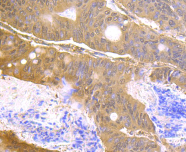 USP14 Antibody in Immunohistochemistry (Paraffin) (IHC (P))