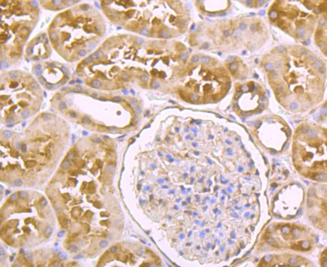 USP14 Antibody in Immunohistochemistry (Paraffin) (IHC (P))