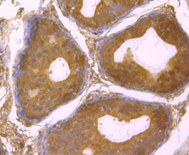 USP14 Antibody in Immunohistochemistry (Paraffin) (IHC (P))