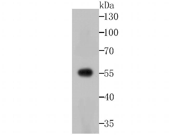 USP14 Antibody in Western Blot (WB)