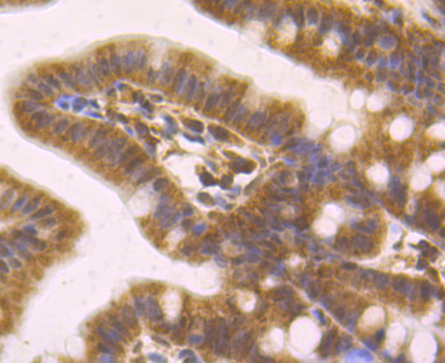 MAD2L2 Antibody in Immunohistochemistry (Paraffin) (IHC (P))