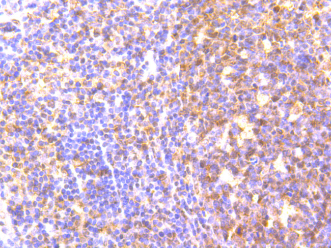 MAD2L2 Antibody in Immunohistochemistry (Paraffin) (IHC (P))