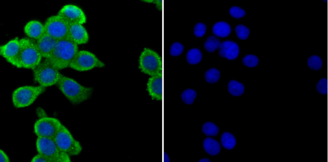 Zap-70 Antibody in Immunocytochemistry (ICC/IF)