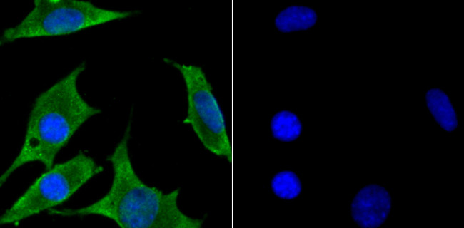 Zap-70 Antibody in Immunocytochemistry (ICC/IF)