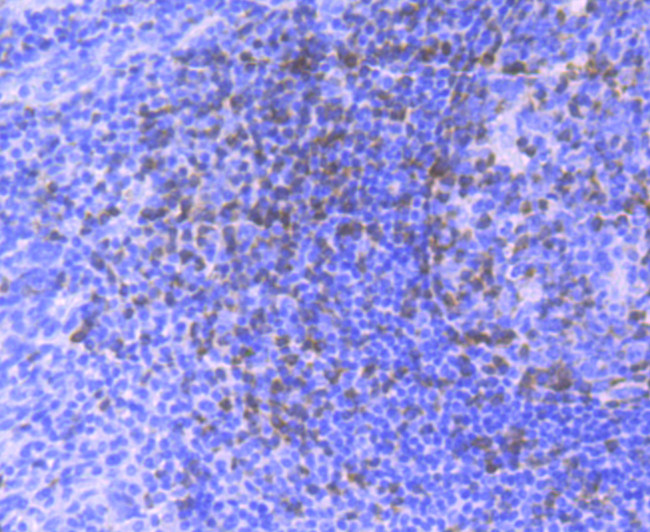 Zap-70 Antibody in Immunohistochemistry (Paraffin) (IHC (P))