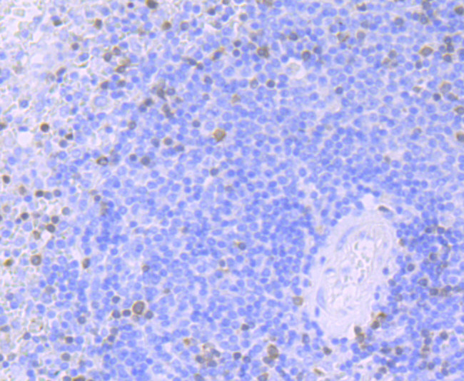 Zap-70 Antibody in Immunohistochemistry (Paraffin) (IHC (P))