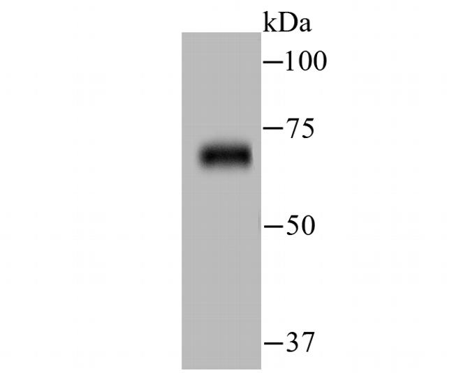 Zap-70 Antibody in Western Blot (WB)