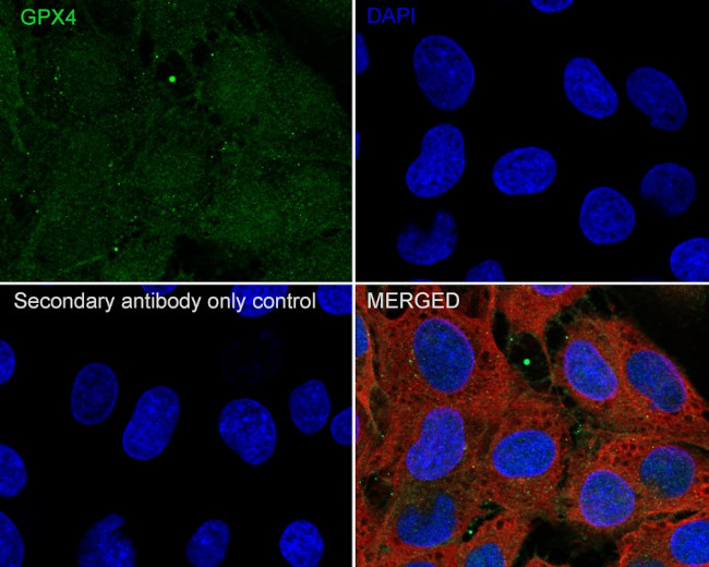 GPX4 Antibody in Immunocytochemistry (ICC/IF)