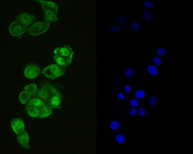 GPX4 Antibody in Immunocytochemistry (ICC/IF)