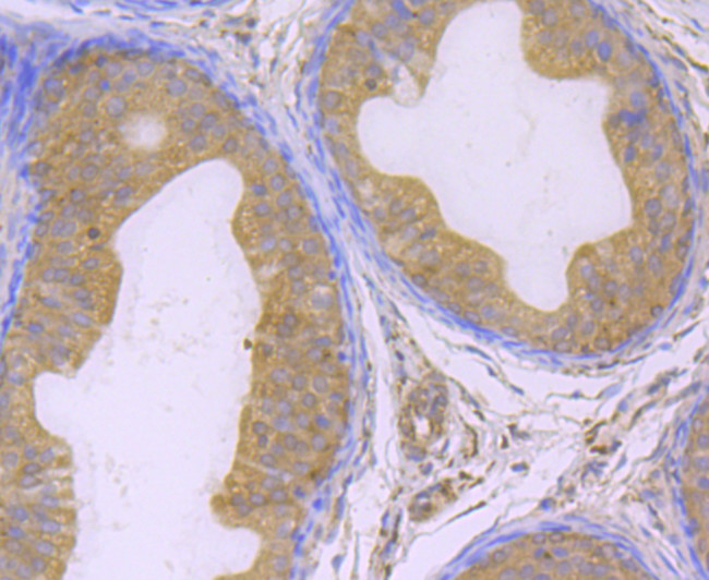 GPX4 Antibody in Immunohistochemistry (Paraffin) (IHC (P))