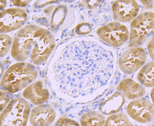 GPX4 Antibody in Immunohistochemistry (Paraffin) (IHC (P))