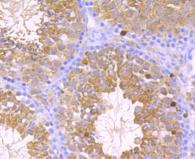 GPX4 Antibody in Immunohistochemistry (Paraffin) (IHC (P))