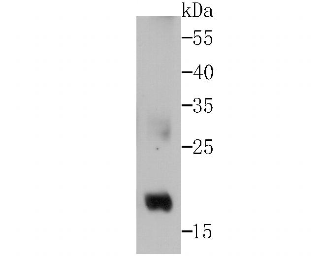 GPX4 Antibody in Western Blot (WB)