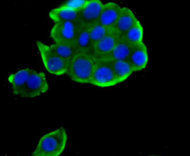 TPT1 Antibody in Immunocytochemistry (ICC/IF)