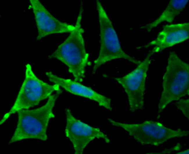 TPT1 Antibody in Immunocytochemistry (ICC/IF)