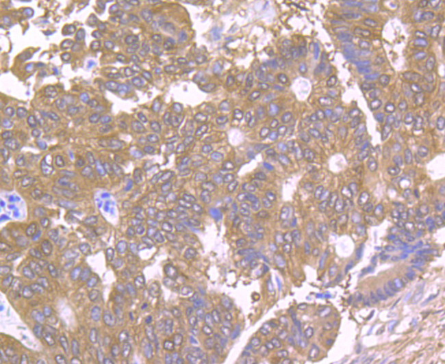 TPT1 Antibody in Immunohistochemistry (Paraffin) (IHC (P))