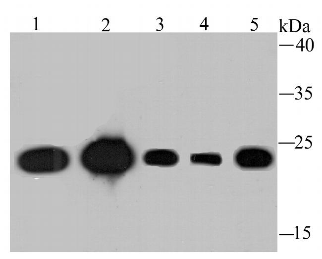 TPT1 Antibody in Western Blot (WB)