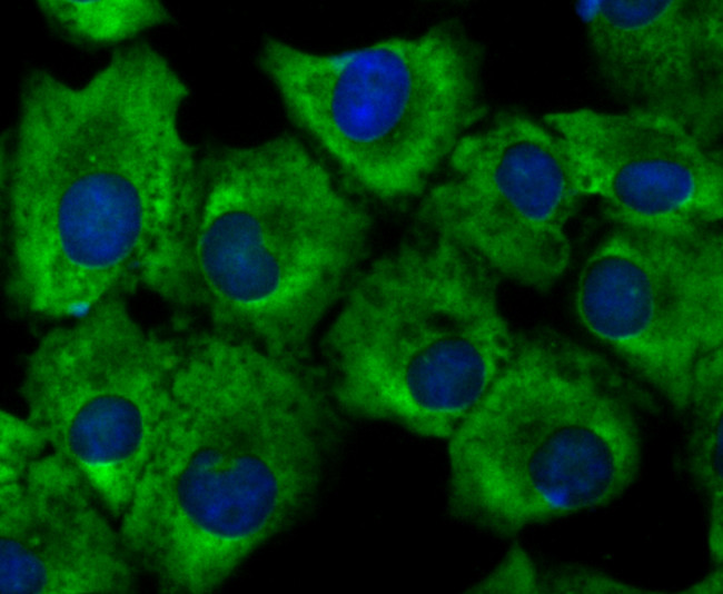 Growth Hormone Receptor Antibody in Immunocytochemistry (ICC/IF)