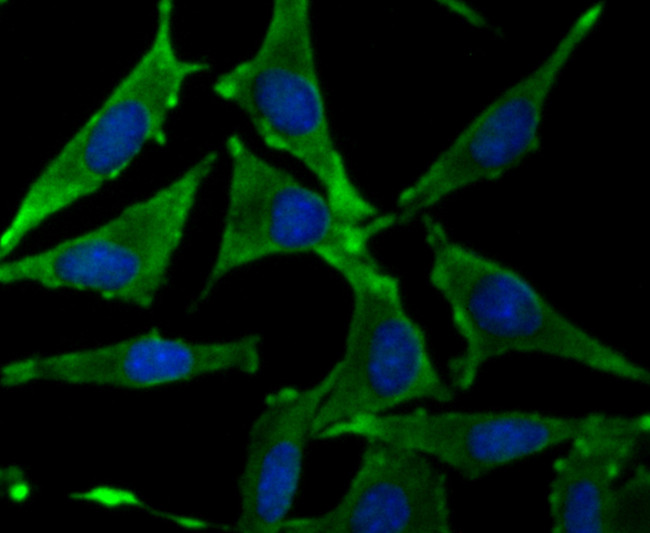 Growth Hormone Receptor Antibody in Immunocytochemistry (ICC/IF)