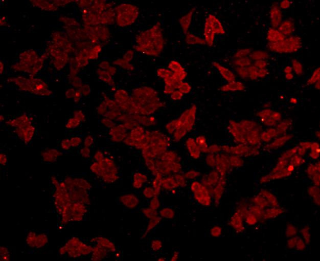 SQSTM1 Antibody in Immunocytochemistry (ICC/IF)