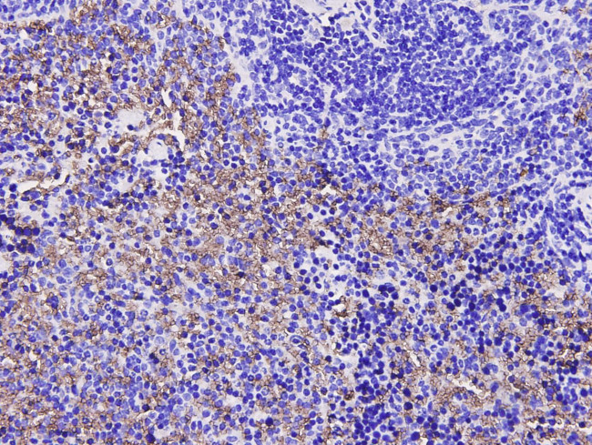 SQSTM1 Antibody in Immunohistochemistry (Paraffin) (IHC (P))