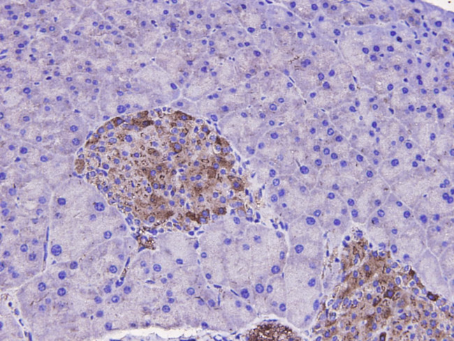 SQSTM1 Antibody in Immunohistochemistry (Paraffin) (IHC (P))