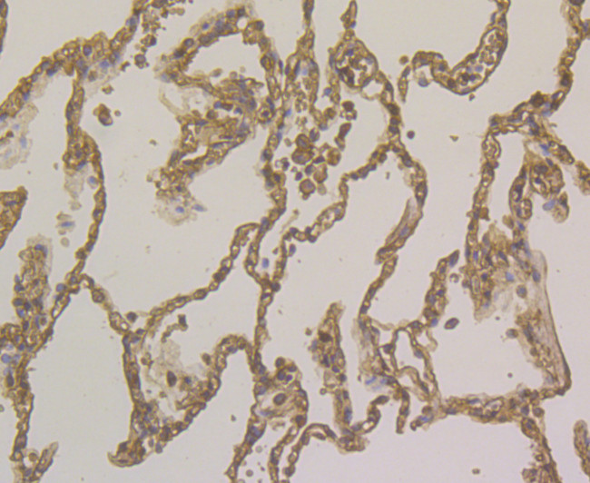 ORM1 Antibody in Immunohistochemistry (Paraffin) (IHC (P))