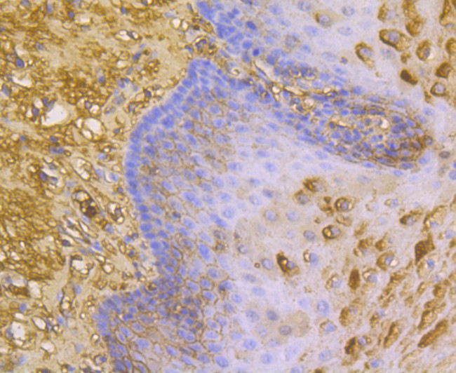 ORM1 Antibody in Immunohistochemistry (Paraffin) (IHC (P))