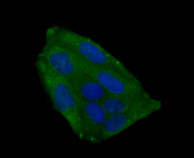 IGF2BP3 Antibody in Immunocytochemistry (ICC/IF)