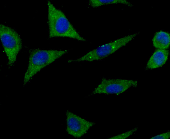 IGF2BP3 Antibody in Immunocytochemistry (ICC/IF)