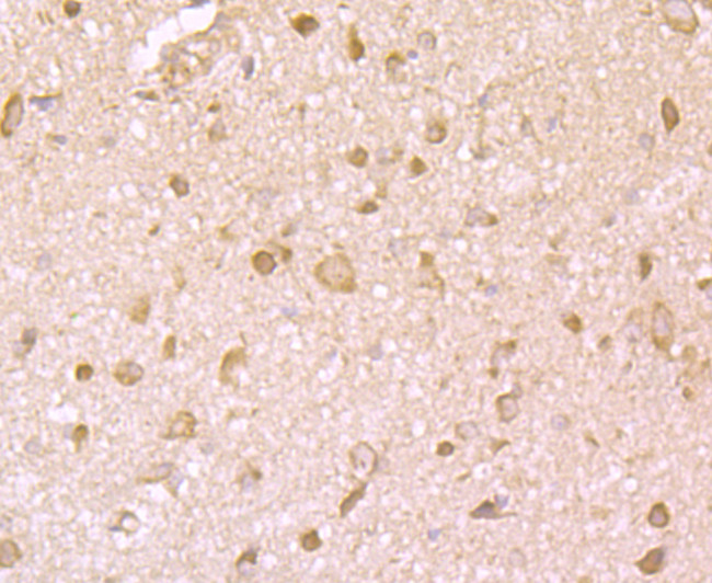 IGF2BP3 Antibody in Immunohistochemistry (Paraffin) (IHC (P))