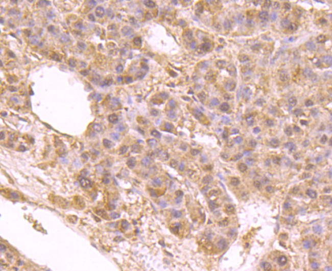 IGF2BP3 Antibody in Immunohistochemistry (Paraffin) (IHC (P))