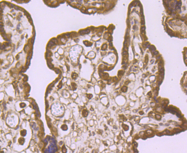 IGF2BP3 Antibody in Immunohistochemistry (Paraffin) (IHC (P))