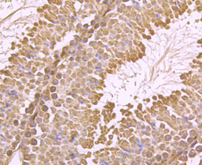 IGF2BP3 Antibody in Immunohistochemistry (Paraffin) (IHC (P))