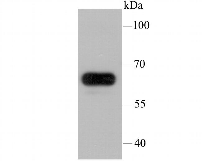 IGF2BP3 Antibody in Western Blot (WB)